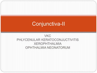 VKC
PHLYCENULAR KERATOCONJUCTIVITIS
XEROPHTHALMIA
OPHTHALMIA NEONATORUM
Conjunctiva-II
 