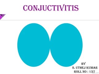 CONJUCTIVITIS
BY
S. UTHEJ KUMAR
ROLL NO : 137
 