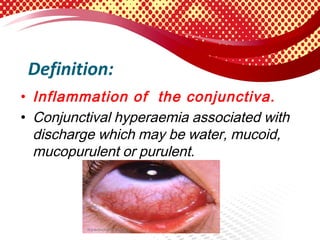 Mucopurulent Conjuctivitis | PPT