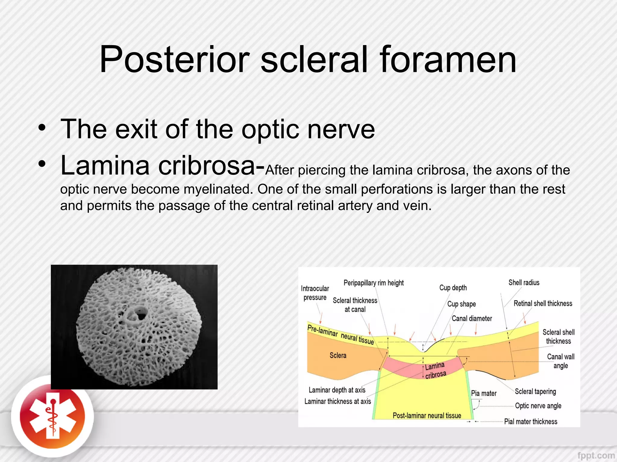 Posterior scleral foramen
• The exit of the optic nerve
• Lamina cribrosa-After piercing the lamina cribrosa, the axons of the
optic nerve become myelinated. One of the small perforations is larger than the rest
and permits the passage of the central retinal artery and vein.
 