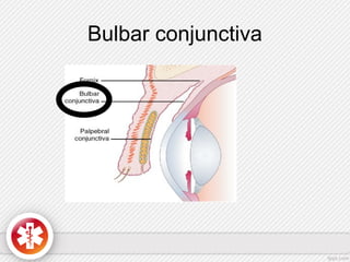 Bulbar conjunctiva
 