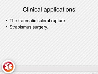 Clinical applications
• The traumatic scleral rupture
• Strabismus surgery.
 
