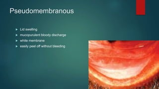 Pseudomembranous
 Lid swelling
 mucopurulent bloody discharge
 white membrane
 easily peel off without bleeding
 