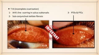 Conjunctiva | PPTX