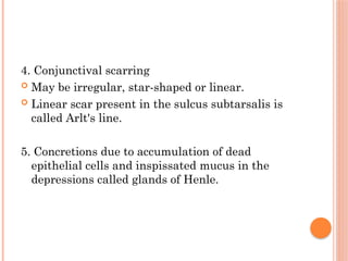 Translucent mucous membrane Lines the posterior surface of the eyelid ...