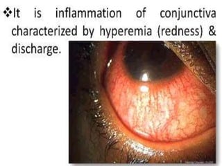 Conjunctiva integrated.pptx