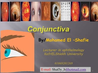 By/Mohamed El –Shafie
Lecturer in ophthalmology
KafrELShiekh University
01069201269
E-mail: Shaf3y_h@hotmail.com 1