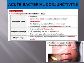 ACUTE BACTERIAL CONJUNCTIVITIS