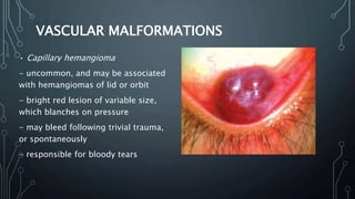 common-conjunctival-conditions-pptx