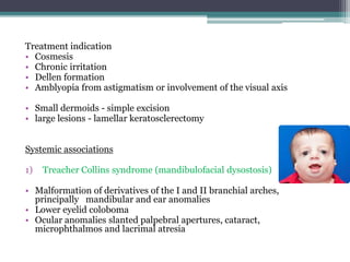 Conjunctival tumors | PPTX