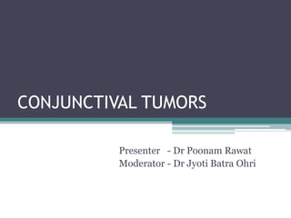 CONJUNCTIVAL TUMORS
Presenter - Dr Poonam Rawat
Moderator - Dr Jyoti Batra Ohri
 