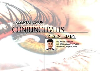 CONJUNCTIVITIS
PRESENTED BY
MD AJMAL SIDDIQUI
DR. OF PHARMACY 2nd
YEAR
Student PU, Gujarat, India
PRESENTATION ON
 