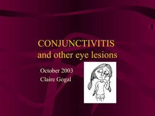 CONJUNCTIVITIS
and other eye lesions
October 2003
Claire Gogal
 
