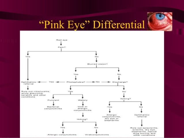 Conjunctivitis pink eye diagram 