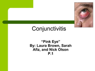 Conjunctivitis

       “Pink Eye”
By: Laura Brown, Sarah
 Afiz, and Nick Olson
           P.1
 