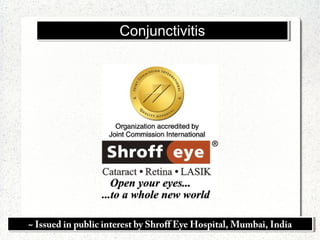 ~ Issued in public interest by Shroff Eye Hospital, Mumbai, India~ Issued in public interest by Shroff Eye Hospital, Mumbai, India
ConjunctivitisConjunctivitis
 