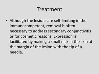 Treatment
• Although the lesions are self-limiting in the
immunocompetent, removal is often
necessary to address secondary conjunctivitis
or for cosmetic reasons. Expression is
facilitated by making a small nick in the skin at
the margin of the lesion with the tip of a
needle.
 