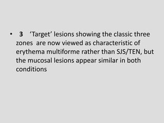 • 3 ‘Target’ lesions showing the classic three
zones are now viewed as characteristic of
erythema multiforme rather than SJS/TEN, but
the mucosal lesions appear similar in both
conditions
 