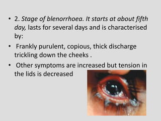 • 2. Stage of blenorrhoea. It starts at about fifth
day, lasts for several days and is characterised
by:
• Frankly purulent, copious, thick discharge
trickling down the cheeks .
• Other symptoms are increased but tension in
the lids is decreased
 