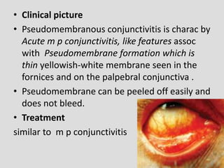 • Clinical picture
• Pseudomembranous conjunctivitis is charac by
Acute m p conjunctivitis, like features assoc
with Pseudomembrane formation which is
thin yellowish-white membrane seen in the
fornices and on the palpebral conjunctiva .
• Pseudomembrane can be peeled off easily and
does not bleed.
• Treatment
similar to m p conjunctivitis
 