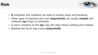 Risk
• If untreated, this condition can lead to corneal ulcers and blindness.
• Other types of bacterial and viral conjunctivitis are usually treated with
antibiotic eye drops or ointments.
• A warm compress to the eye may also help relieve swelling and irritation
• Blocked tear ducts may cause conjunctivitis.
@ Dr. Prasad B. Chinchole
 