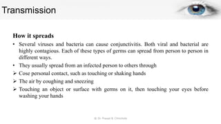 Transmission
How it spreads
• Several viruses and bacteria can cause conjunctivitis. Both viral and bacterial are
highly contagious. Each of these types of germs can spread from person to person in
different ways.
• They usually spread from an infected person to others through
 Cose personal contact, such as touching or shaking hands
 The air by coughing and sneezing
 Touching an object or surface with germs on it, then touching your eyes before
washing your hands
@ Dr. Prasad B. Chinchole
 