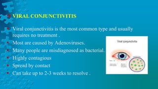  Viral conjunctivitis is the most common type and usually
requires no treatment .
 Most are caused by Adenoviruses.
 Many people are misdiagnosed as bacterial.
 Highly contagious
 Spread by contact
 Can take up to 2-3 weeks to resolve .
 VIRAL CONJUNCTIVITIS
 
