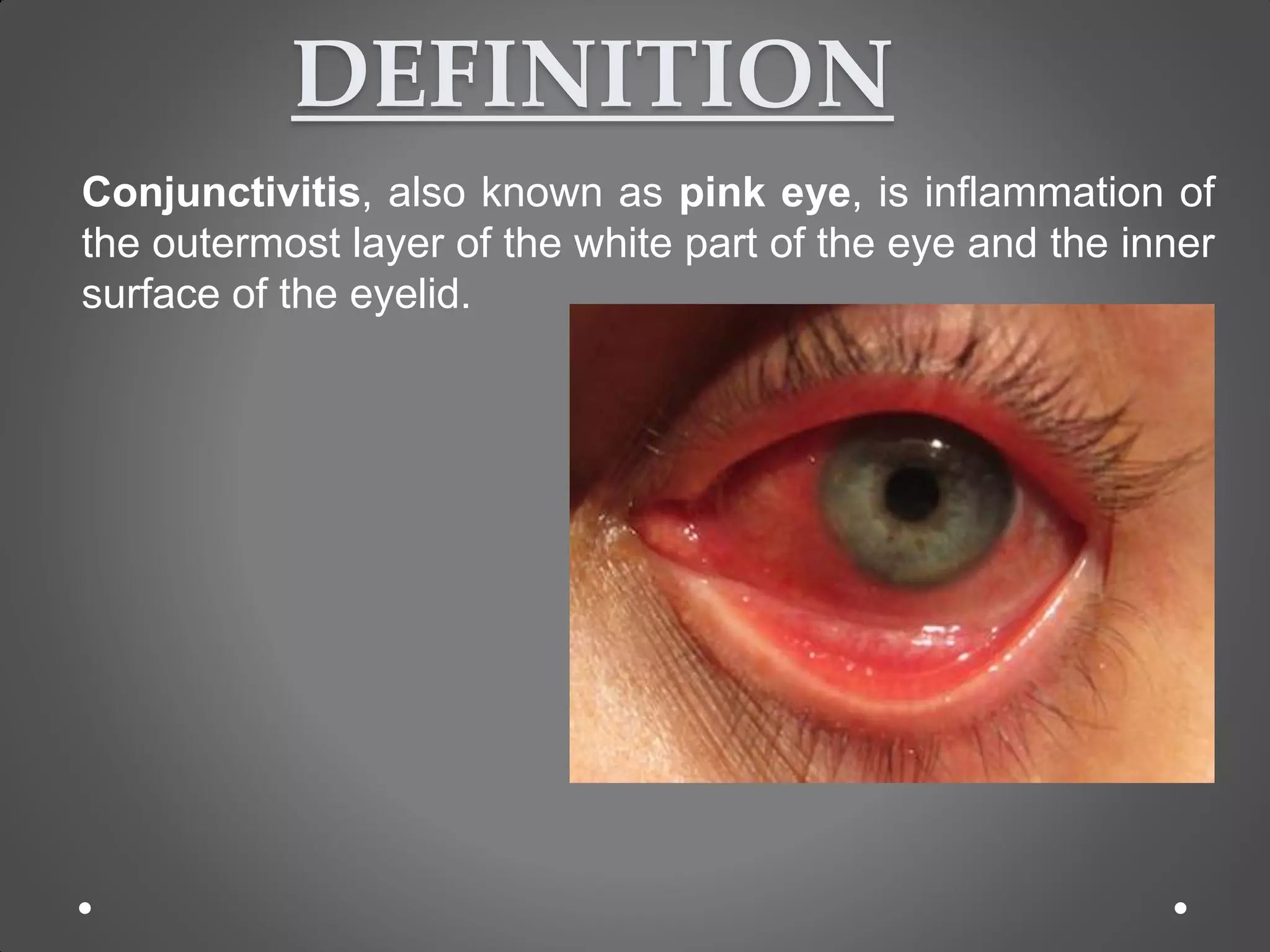 DEFINITION
Conjunctivitis, also known as pink eye, is inflammation of
the outermost layer of the white part of the eye and the inner
surface of the eyelid.
 