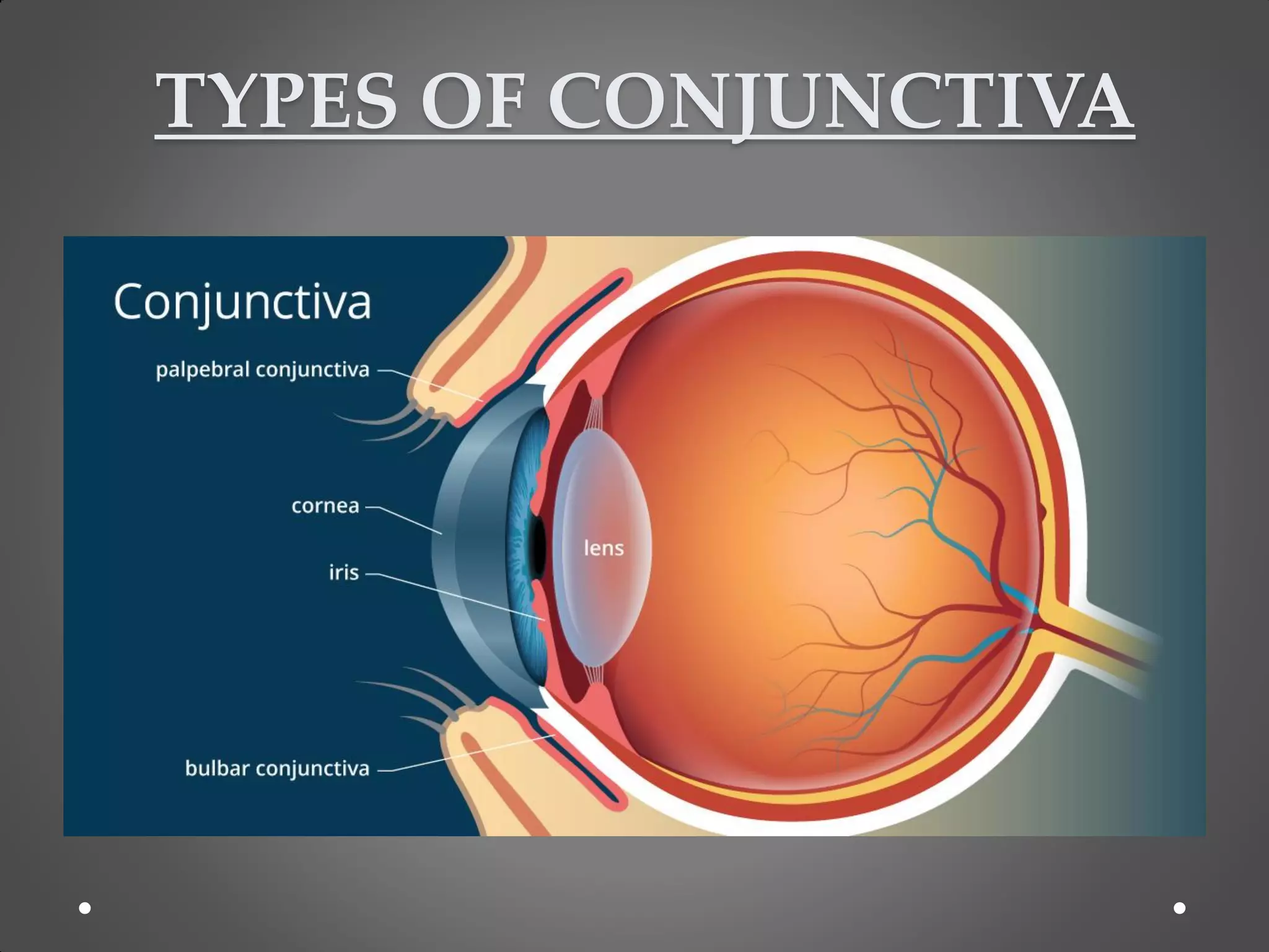 TYPES OF CONJUNCTIVA
 