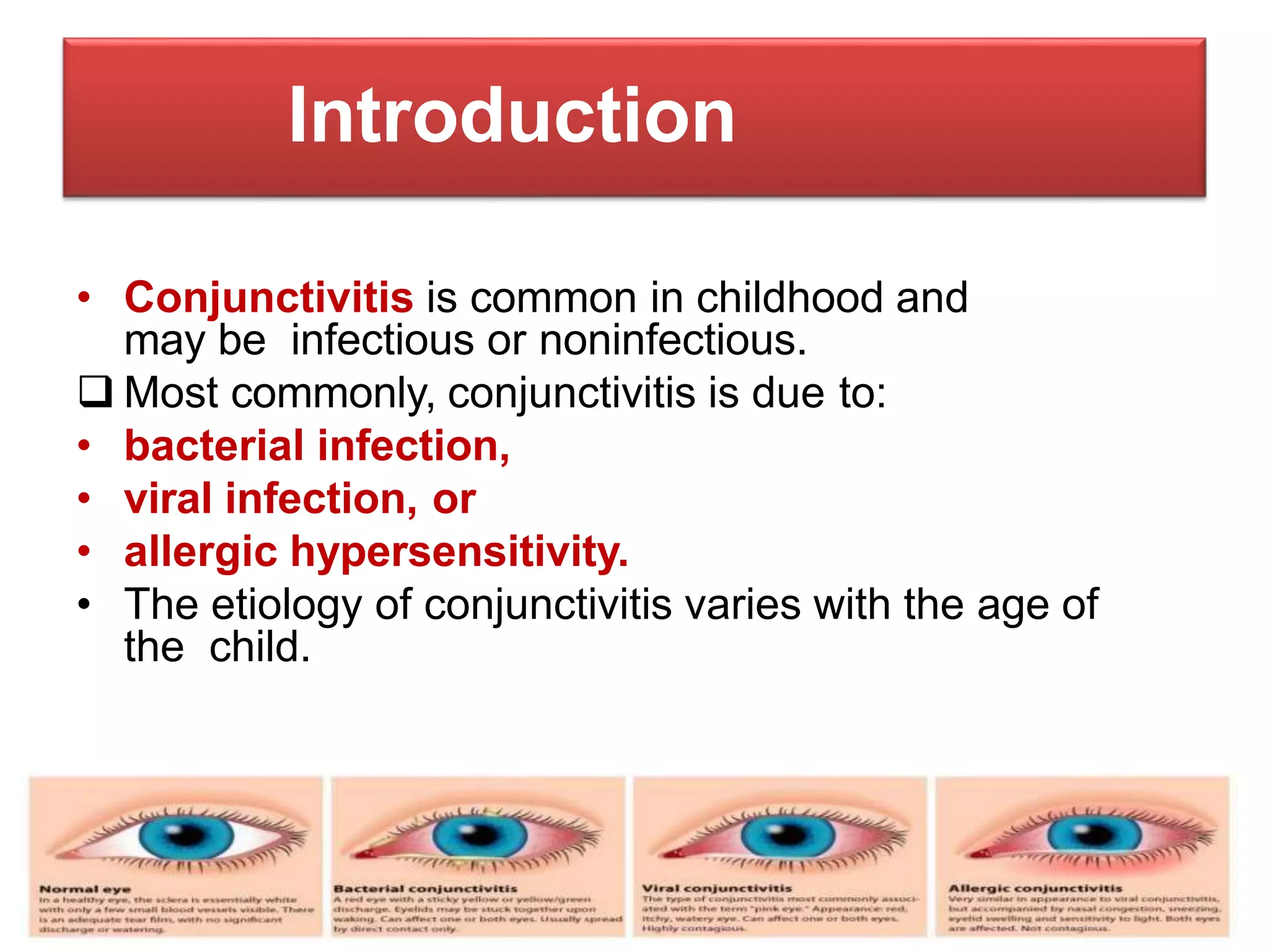 Bacterial vs Viral Conjunctivitis: Signs, Symptoms and Treatment | PPT