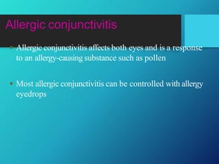 Allergic conjunctivitis
 Allergic conjunctivitis affects both eyes and is a response
to an allergy-causing substance such as pollen
 Most allergic conjunctivitis can be controlled with allergy
eyedrops
 