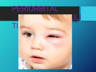 PERIORBITAL
CELLULI
TIS
 