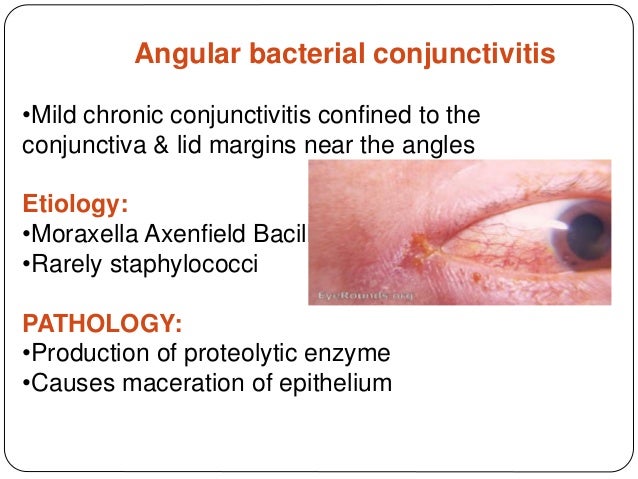 treatment excoriation skin Conjunctivitis