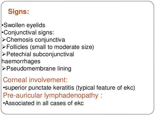 Conjunctivitis