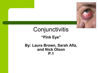 Conjunctivitis
        “Pink Eye”

By: Laura Brown, Sarah Afiz,
      and Nick Olson
            P.1
 