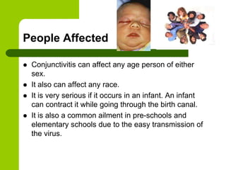 People Affected

   Conjunctivitis can affect any age person of either
    sex.
   It also can affect any race.
   It is very serious if it occurs in an infant. An infant
    can contract it while going through the birth canal.
   It is also a common ailment in pre-schools and
    elementary schools due to the easy transmission of
    the virus.
 