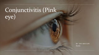 Conjunctivitis (Pink
eye)
B Y D R M AY U R I
R A N I
 
