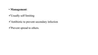 • Management:
Usually self limiting
Antibiotic to prevent secondary infection
Prevent spread to others.
 