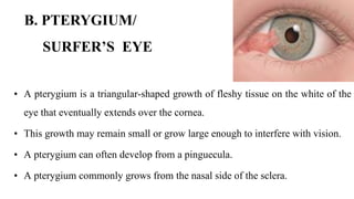 B. PTERYGIUM/
SURFER’S EYE
• A pterygium is a triangular-shaped growth of fleshy tissue on the white of the
eye that eventually extends over the cornea.
• This growth may remain small or grow large enough to interfere with vision.
• A pterygium can often develop from a pinguecula.
• A pterygium commonly grows from the nasal side of the sclera.
 
