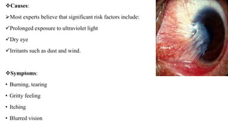 Causes:
Most experts believe that significant risk factors include:
Prolonged exposure to ultraviolet light
Dry eye
Irritants such as dust and wind.
Symptoms:
• Burning, tearing
• Gritty feeling
• Itching
• Blurred vision
 