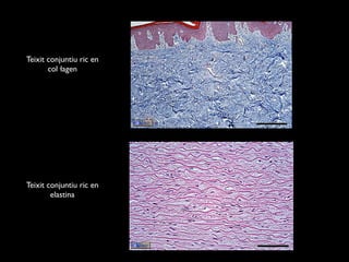 Teixit conjuntiu ric en
       col·lagen




Teixit conjuntiu ric en
        elastina
 