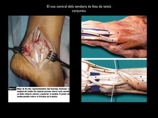 El cos central dels tendons és feta de teixit
                 conjuntiu
 