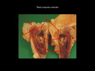 Teixit conjuntiu reticular
 