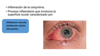 • Inflamación de la conjuntiva.
• Proceso inflamatorio que involucra la
superficie ocular caracterizado por:
Dilatación vascular.
Infiltración célular.
Exudación.
 