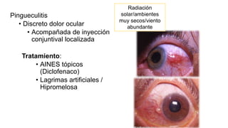Pingueculitis
• Discreto dolor ocular
• Acompañada de inyección
conjuntival localizada
Tratamiento:
• AINES tópicos
(Diclofenaco)
• Lagrimas artificiales /
Hipromelosa
Radiación
solar/ambientes
muy secos/viento
abundante
 