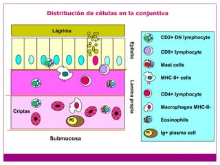 CD2+ DN lymphocyteLágrimaCD8+ lymphocyteMast cellsEpitelioMHC-II+ cellsCD4+ lymphocyteMacrophages MHC-II-Lamina propiaEosinophilsCriptasIg+ plasma cellDistribución de células en la conjuntivaSubmucosaAdaptado de Vega-Lopez, et al., 1993, 2001.