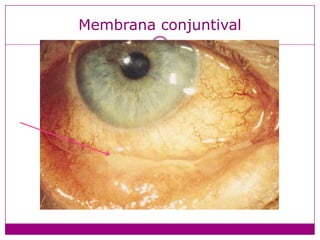 Membrana conjuntival