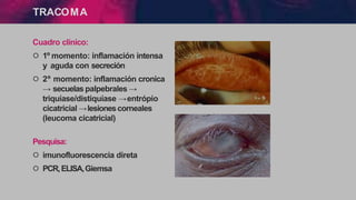 TRACOMA
Cuadro clínico:
੦ 1º momento: inflamación intensa
y aguda con secreción
੦ 2º momento: inflamación cronica
→ secuelas palpebrales →
triquíase/distiquíase →entrópio
cicatricial →lesionescorneales
(leucoma cicatricial)
Pesquisa:
੦ imunofluorescencia direta
੦ PCR,ELISA,Giemsa
 