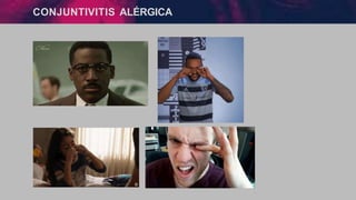 CONJUNTIVITIS ALÉRGICA
 