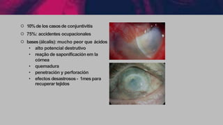 ੦ 10%de los casosde conjuntivitis
੦ 75%: accidentes ocupacionales
੦ bases(álcalis): mucho peor que ácidos
• alto potencial destrutivo
• reação de saponificación em la
córnea
• quemadura
• penetración y perforación
• efectos desastrosos- 1mespara
recuperar tejidos
 
